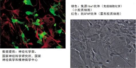 兔源Iba1抗体（免疫组化）小胶质细胞/巨噬细胞特异性蛋白抗体 | WAKO和光纯药官网