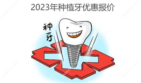 2023年种植牙优惠报价,集采后士卓曼报价873元起/诺贝尔1855元 - 口腔资讯 - 牙齿矫正网