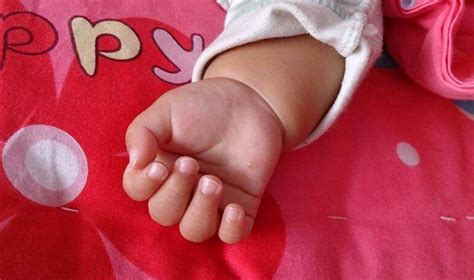 如何区分儿童水泡疹图片（夏天宝宝手上长的小水泡是什么？这还是宝宝的手吗？要紧不？） | 说明书网