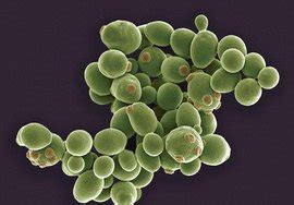 生活小常识：酵母菌的生殖方式 - 装修保障网