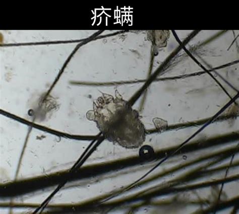 澳洲可得治皮肤膏疥螨蠕形螨细菌真菌图片