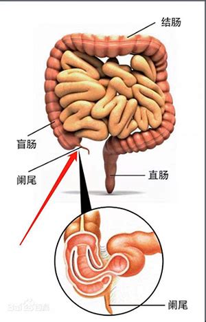 阑尾炎疼痛位置图图片
