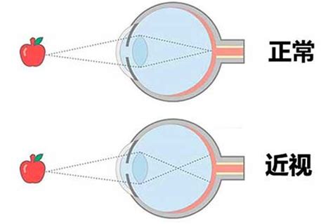 贝茨护眼仪眼部按摩器缓解疲劳学生近视训练神器儿童保护眼睛视力-阿里巴巴