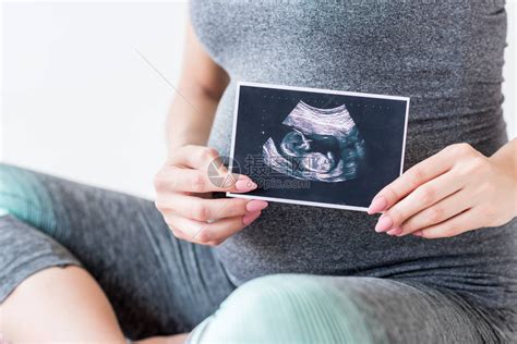 穿着运动服的孕妇的裁剪视图显示未出生婴儿的超声波扫高清图片下载-正版图片503352679-摄图网