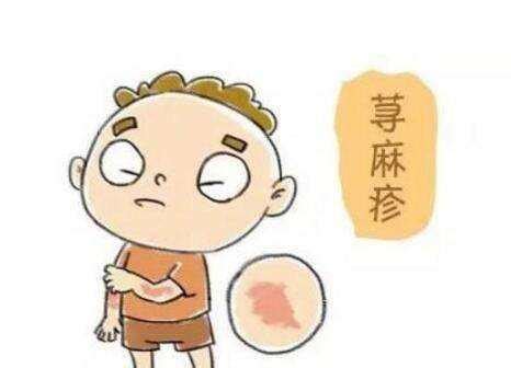 荨麻疹的有效治疗方法是什么_北京京城皮肤医院(北京医保定点机构)_ 皮肤病大全