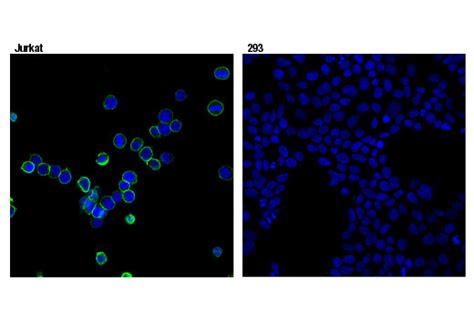 促炎性巨噬细胞亚群CD45+CD11b+F4/80+CD14+及其应用