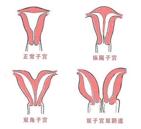 石女图片