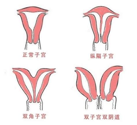 人形蚊香是什么意思-趣百科