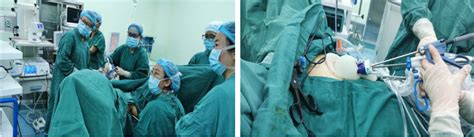 妇产科新开展单孔腹腔镜全子宫切除术