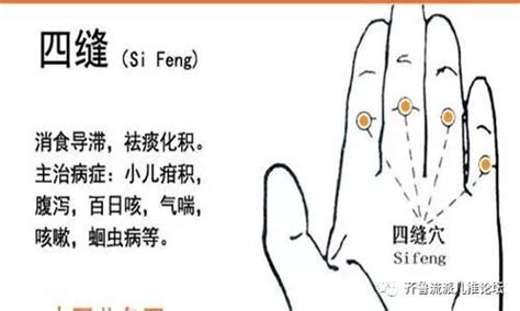 四缝的准确位置图图片 四缝的准确位置图图片