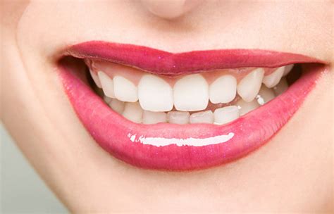 如何美白牙齿 美白牙齿的方法有什么_千颜网