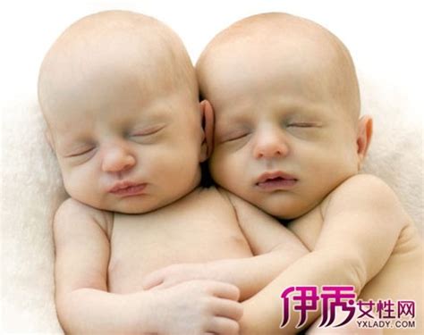 【双胞胎宝宝图片】【图】双胞胎宝宝图片欣赏 4个方法教你提高生双胞胎的机率(3)_伊秀亲子|yxlady.com