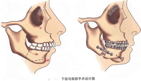 颏部具体位置图片