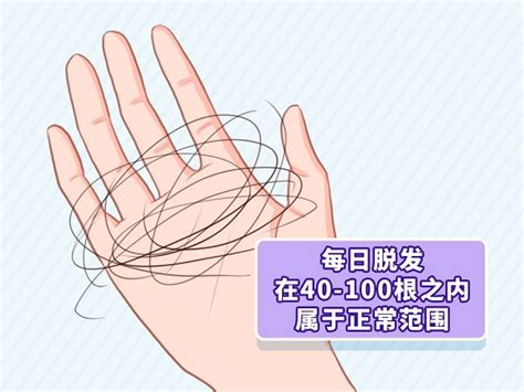 中华医学会 科普图文 头发是种什么物质？每天掉多少才算异常？