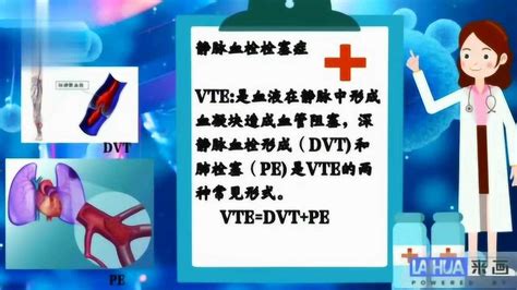 0106病区VTE宣教 _腾讯视频