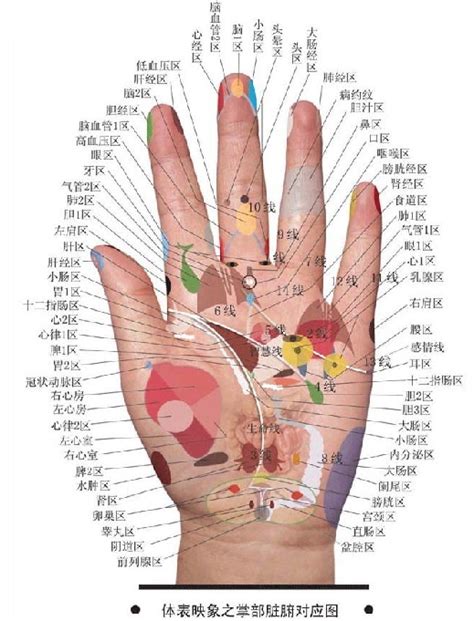手诊图解看疾病图片