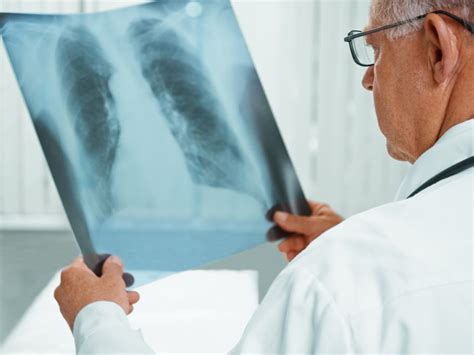 肺结核的六大临床分型，你一定要知道_医学界-助力医生临床决策和职业成长