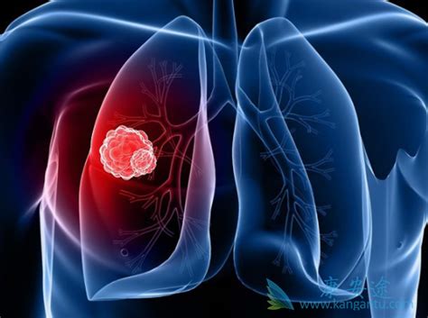 肺癌晚期最怕三个征兆：呼吸弱/心率不稳定/血压低（及时治疗）_奇趣解密网