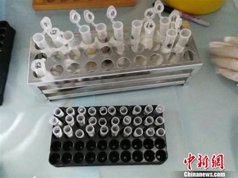 云南：头发样本毒品检测研究取得阶段性成果-中国禁毒网