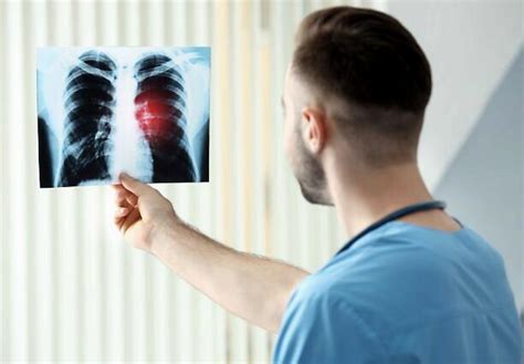 肺癌3个早期症状别忽视，很多人发现时已是晚期 - 知乎