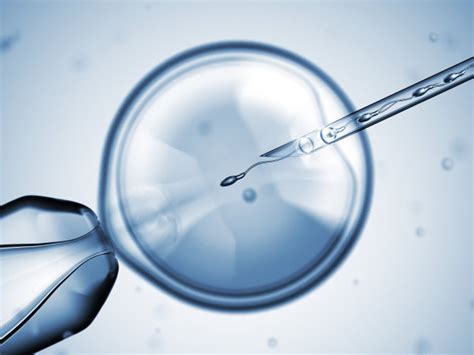 用于人工授精或体外受精的带有针头和精子的卵子人工授精或生育治疗高清图片下载-正版图片504193905-摄图网