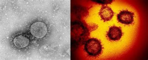 清华团队曝光“新冠病毒”3D高清结构照！这个恶魔已感染1亿地球人_凤凰网