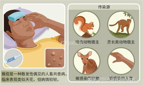 海外网评：占全球猴痘病例超34%，美国又成抗疫“差等生”|界面新闻 · 中国