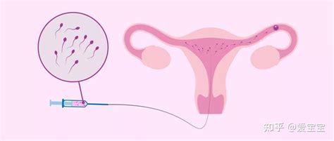 5个步骤教你自判精子质量，如果精液有这些问题，可能影响生育 - 知乎