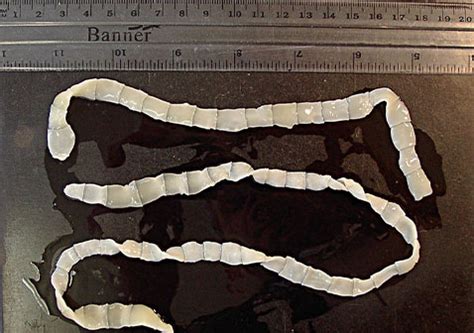 牛带绦虫 的图像结果