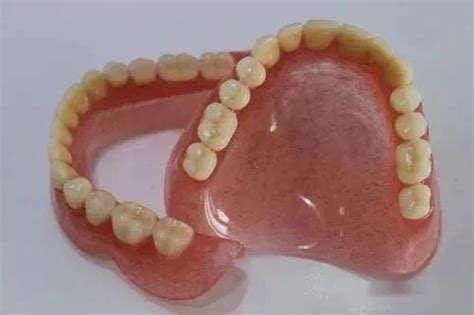 目前最先进的活动义齿有覆盖性义齿/吸附性义齿/纯钛假牙…-儿牙-妈妈好孕网