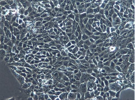 4T1细胞；小鼠**细胞；4T1-UDP糖丨MOF丨金属有机框架丨聚集诱导发光丨荧光标记推荐西安齐岳生物