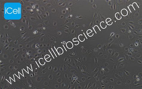 细胞形态异常剖析 Step2 - 技术前沿 - 资讯 - 生物在线