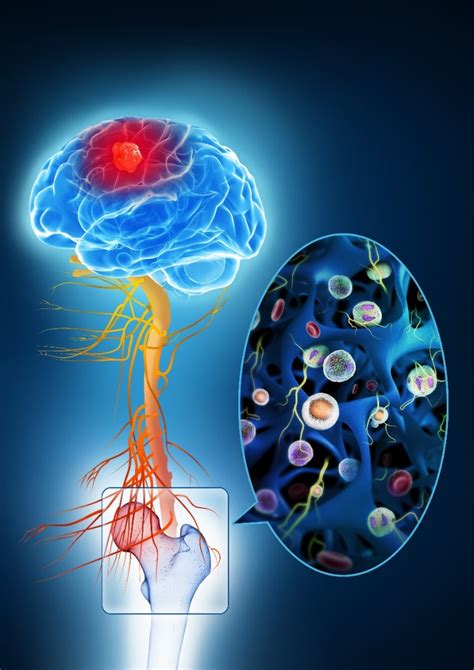 刘强课题组Science Translational Medicine发现脑损伤后骨髓造血系统的新功能——抑制神经炎症_脑出血_骨髓造血干细胞_医脉通