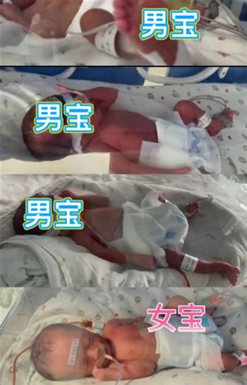 新乡产妇第三胎生下龙凤四胞胎，取名惊艳网友_育儿资讯