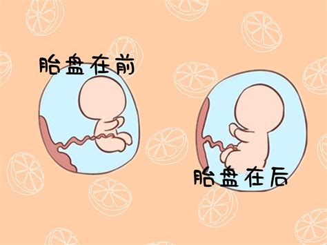 孕期出现胎盘前置，和这些因素脱不了干系，希望你能幸运规避__凤凰网