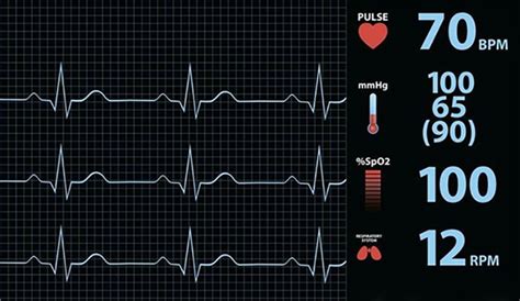 心力衰竭患者出院静息心率对全因死亡的影响 心脏康复网—心脏康复领域专业学术平台