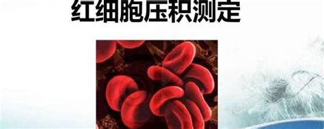 【血液学必知】红细胞压积测量方法及检测意义_血浆_白细胞_血沉