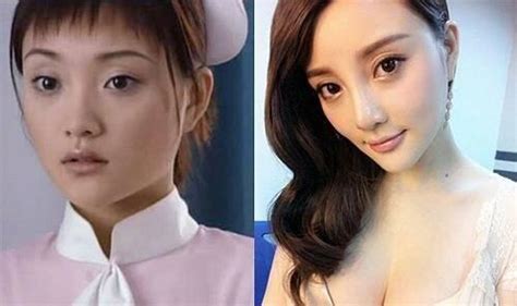熊黛林眼睛整容了嘛图片