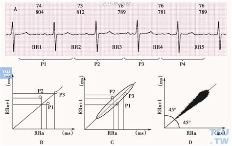 四、心脏的传导组织与心脏除极-临床心脏电生理学-医学