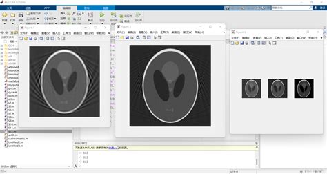 iradon，ira冬日赤脚