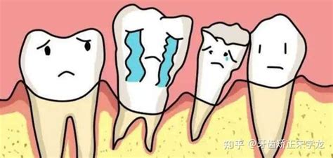 造成牙齿松动的原因有哪些？ - 知乎