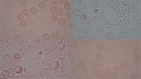 白细胞图片显微镜,白细胞形态,五种白细胞形态图(第4页)_大山谷图库