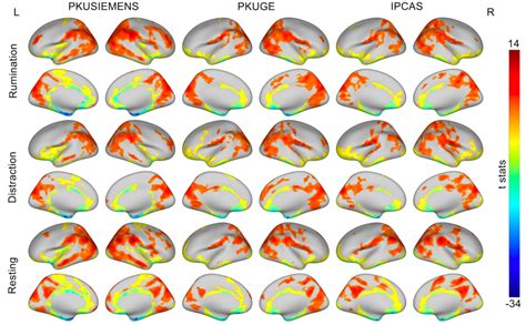 NeuroImage：心理所发表反刍思维状态下脑活动动态稳定性特征|中国科学院_新浪新闻