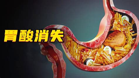 胃酸分泌过多的人，建议多吃这4种食物，养护胃粘膜，缓解不适|胃酸|食物|黏膜_新浪新闻