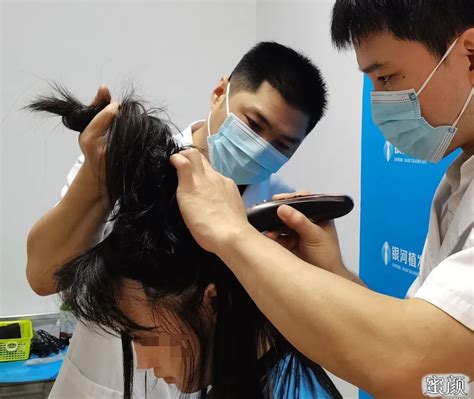 上海正规植发医院排名榜,来看毛发专科医院都排名第几！,美人尖种植-8682赴韩整形网