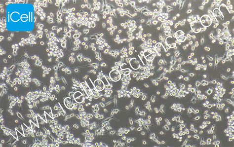 MC38 小鼠结肠癌细胞-原代细胞-STR细胞-细胞培养基-赛百慷生物