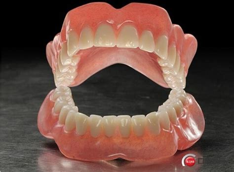 全口义齿病例（附视频）-宁波朱静峰的博客-KQ88口腔博客