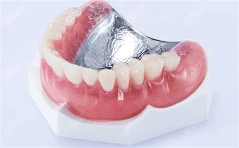 2022年中国义齿（假牙）行业发展现状，各类义齿及牙科医用材料需求持续增加「图」_华经情报网_华经产业研究院