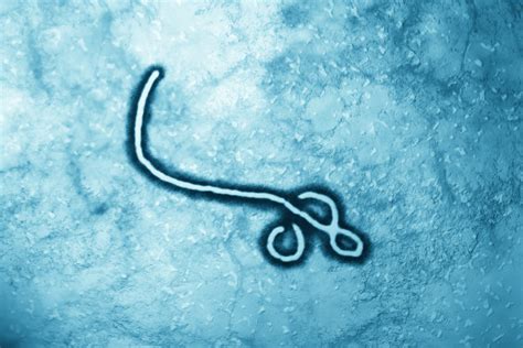 埃博拉病毒,显微镜,在下面,病毒,概念和主题,瘟疫,无人,绘画插图,健康保健,传染病摄影素材,汇图网www.huitu.com