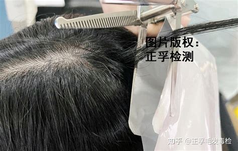 毛发检测-毛发毒品检测--头发检测机构-正光毛发检测中心